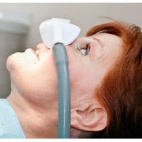 We offer many types of sedation at Dodson & Royzenblat Endodontics, like Nitrous Oxide (Inhalation)