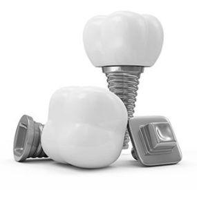 Dental Implants at Our Commerce Twp. Area Dental Office