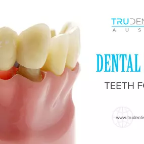 Dental Bridges - TRU Dentistry Austin (Dentist 78704)