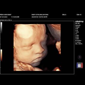 Bild von Peek a Boo Baby 3D 4D Ultrasound