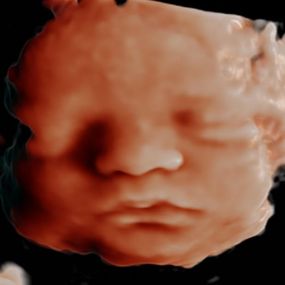 Bild von Peek a Boo Baby 3D 4D Ultrasound