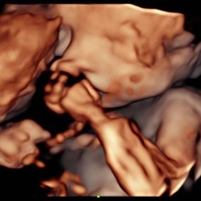 Bild von Peek a Boo Baby 3D 4D Ultrasound