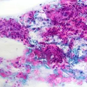 Bild von GP für Pathologie & Zytologie Köln Weyertal - Dr. Mellin und Dr. Melzer