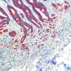 Bild von GP für Pathologie & Zytologie Köln Weyertal - Dr. Mellin und Dr. Melzer