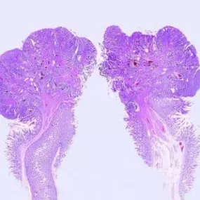 Polyp unter dem Mikroskop