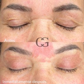 MICROBLADING-TORRELAVEGA.jpeg