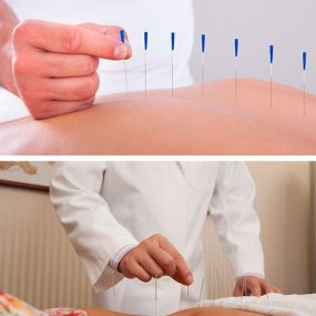 medico-acupuntor-aviles.jpg