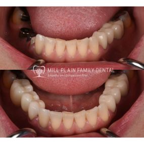 Bild von Mill Plain Family Dental