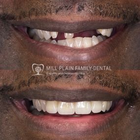 Bild von Mill Plain Family Dental