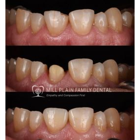 Bild von Mill Plain Family Dental