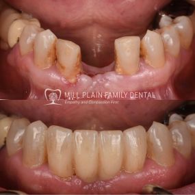 Bild von Mill Plain Family Dental