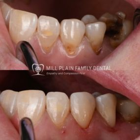 Bild von Mill Plain Family Dental