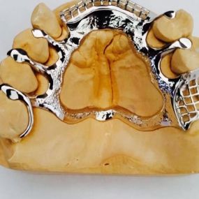 Bild von Chrome Cast Dental Laboratory