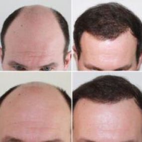 Bild von Capital Hair Restoration