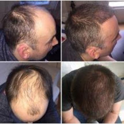 Logótipo de Capital Hair Restoration