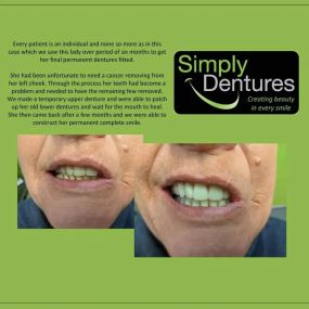 Bild von Simply Dentures