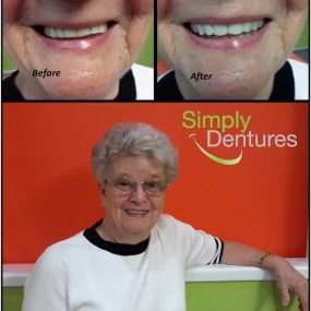 Bild von Simply Dentures