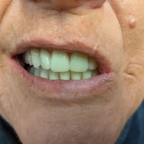 Bild von Simply Dentures