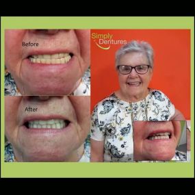 Bild von Simply Dentures