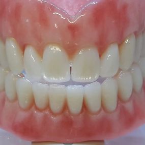 Bild von Simply Dentures