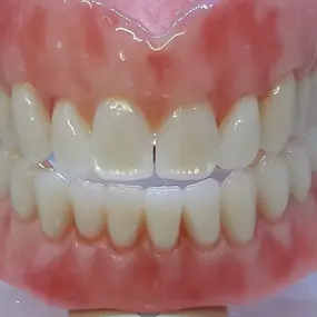 Bild von Simply Dentures