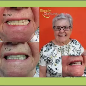 Bild von Simply Dentures