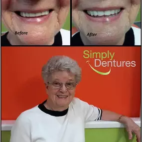 Bild von Simply Dentures