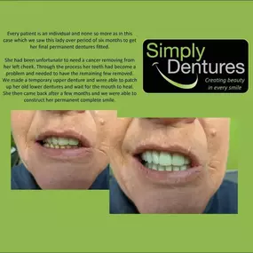Bild von Simply Dentures