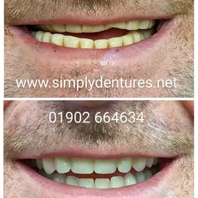 Bild von Simply Dentures