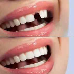 Bild von Leon Corns Denture Services