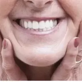 Bild von Albany Denture Centre