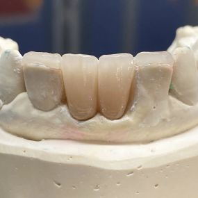 Bild von Steve Butler Dental Ceramics Ltd