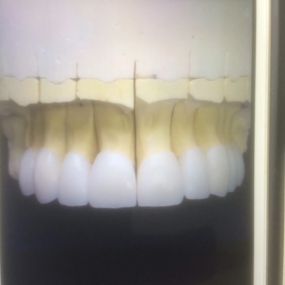 Bild von Steve Butler Dental Ceramics Ltd