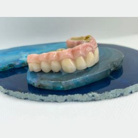 Bild von Steve Butler Dental Ceramics Ltd