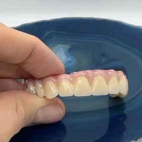 Bild von Steve Butler Dental Ceramics Ltd