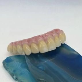 Bild von Steve Butler Dental Ceramics Ltd