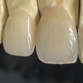 Bild von Steve Butler Dental Ceramics Ltd