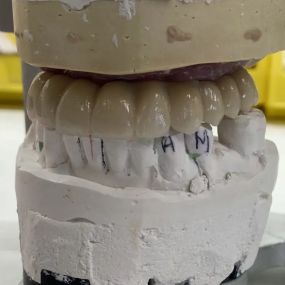 Bild von Steve Butler Dental Ceramics Ltd