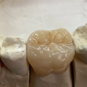 Bild von Steve Butler Dental Ceramics Ltd