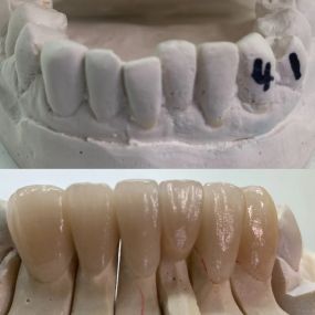 Bild von Steve Butler Dental Ceramics Ltd