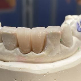 Bild von Steve Butler Dental Ceramics Ltd