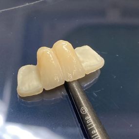 Bild von Steve Butler Dental Ceramics Ltd