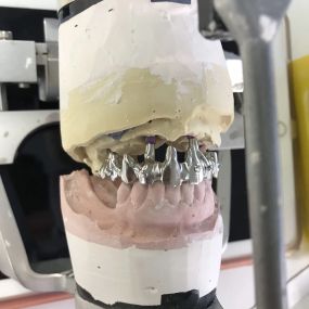 Bild von Steve Butler Dental Ceramics Ltd