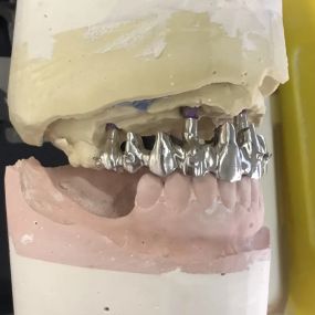 Bild von Steve Butler Dental Ceramics Ltd