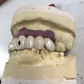 Bild von Steve Butler Dental Ceramics Ltd