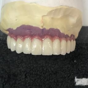 Bild von Steve Butler Dental Ceramics Ltd