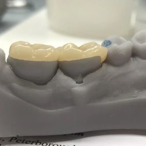 Bild von Steve Butler Dental Ceramics Ltd