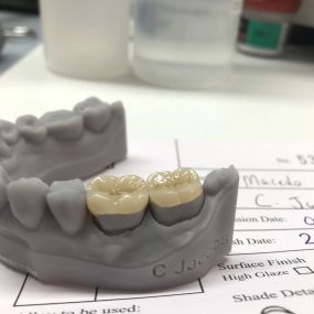 Bild von Steve Butler Dental Ceramics Ltd