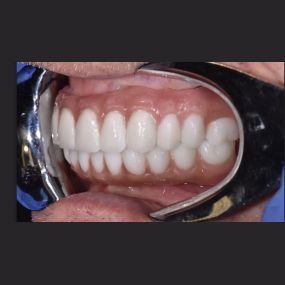 Bild von Steve Butler Dental Ceramics Ltd