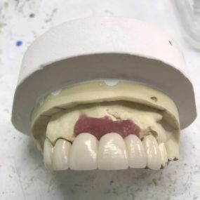 Bild von Steve Butler Dental Ceramics Ltd